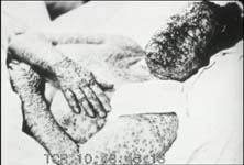 Outbreak: Anatomy of a Plague